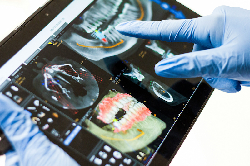 Dental X-ray on tablet